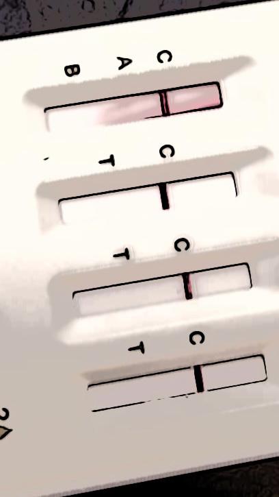 Laborproben und Urinteststreifen für die Diagnostik